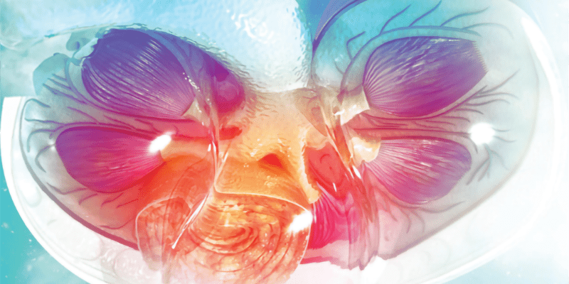 CMDAToday Kidney